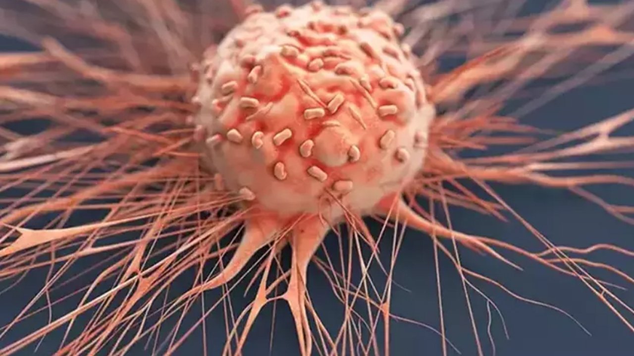 Penis kanseri yayılıyor! 10 yılda 6 bin 500 ampütasyon